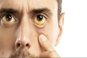 What Your Eyes Are Trying to Tell You: Early Symptoms Fulton County Patients Shouldn’t Ignore