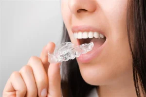 Teeth Aligners
