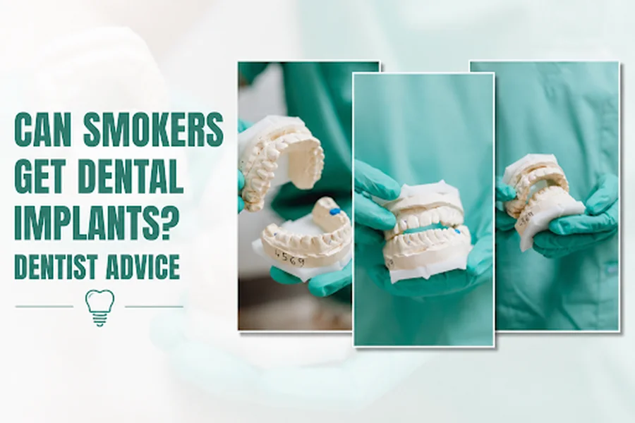 Can Smokers Get Dental Implants Dentist Advice