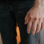 Wounds